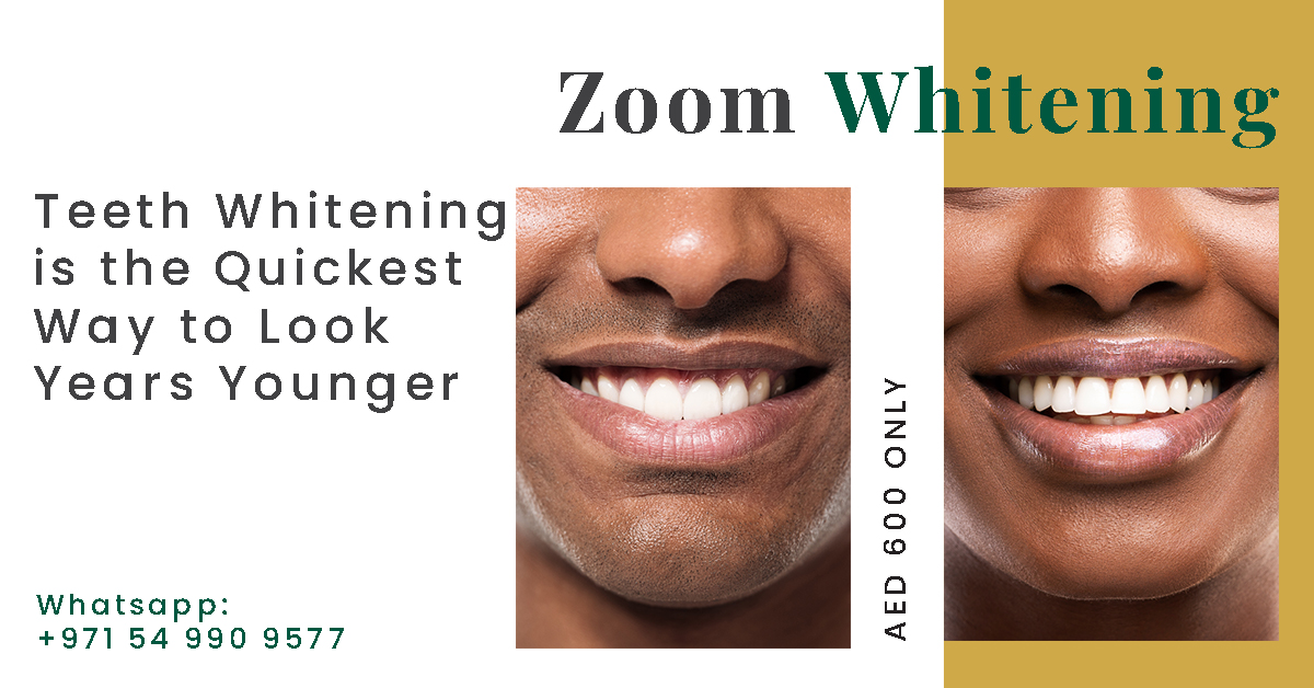 Teeth Whitening is the Quickest Way to Look Years Younger Dr. Sunny