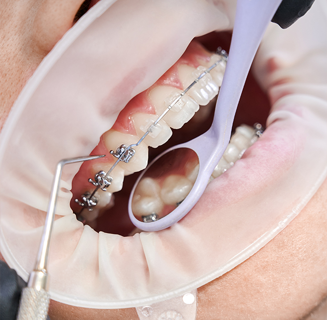 Common Orthodontics Problems