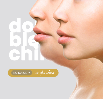 double chin reduction