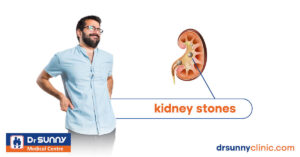 kidney stones best nephrologist in Sharjah