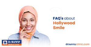 FAQ's about Hollywood Smile