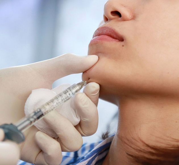 Chin Augmentation Filler treatment in sharjah