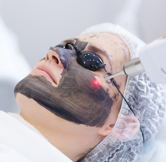 Carbon Laser Facial Sharjah