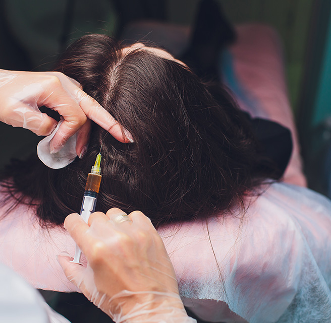 prp treatment for hair loss in sharjah