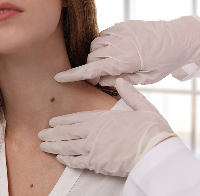 skin tag removal treatment sharjah