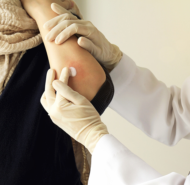 Skin infections treatment in sharjah