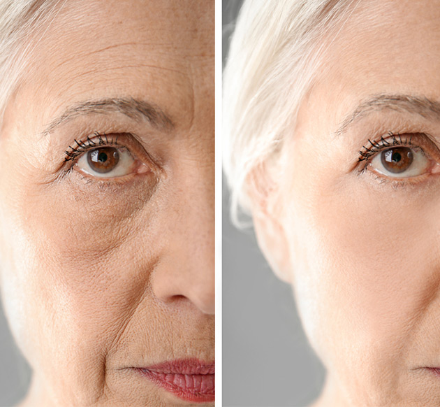 anti ageing treatment sharjah