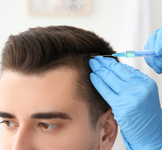 mesotherapy for hair loss treatment