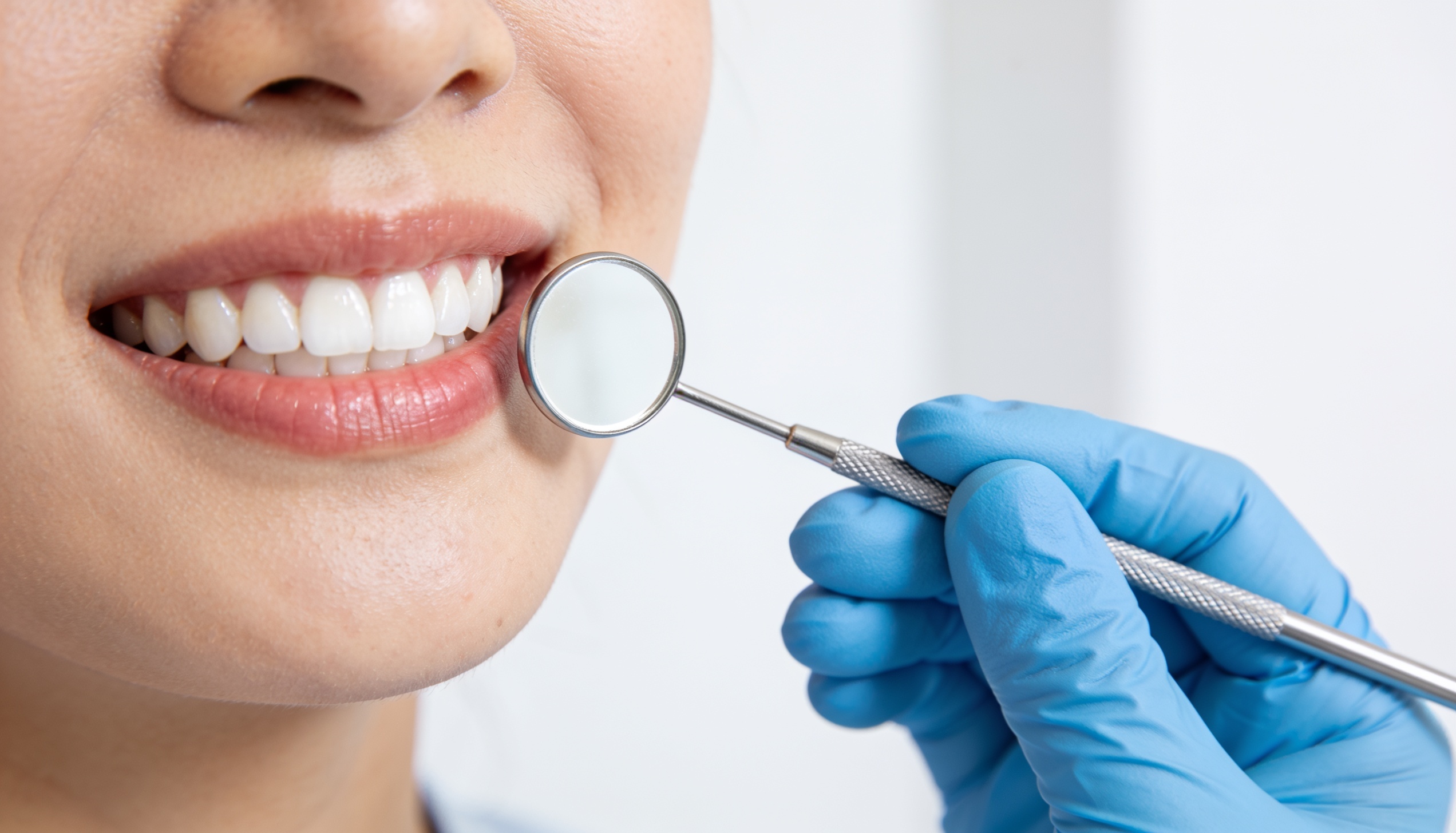 Hollywood Smile in Umm Al Quwain: What It Involves & Who It Suits