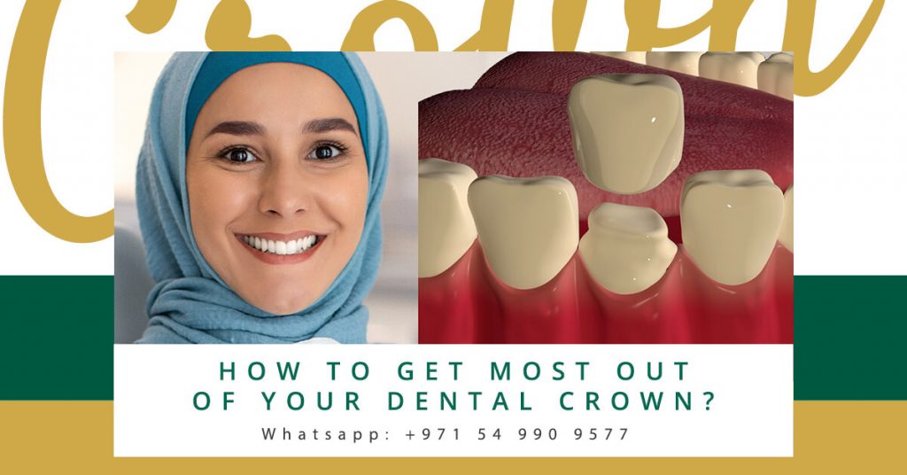 dental crown bridges