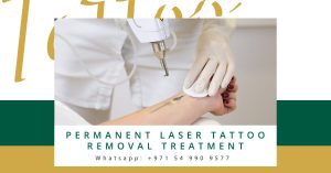 tattoo removal