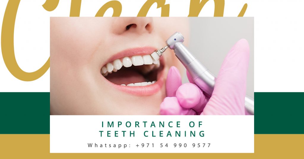 Teeth Cleaning