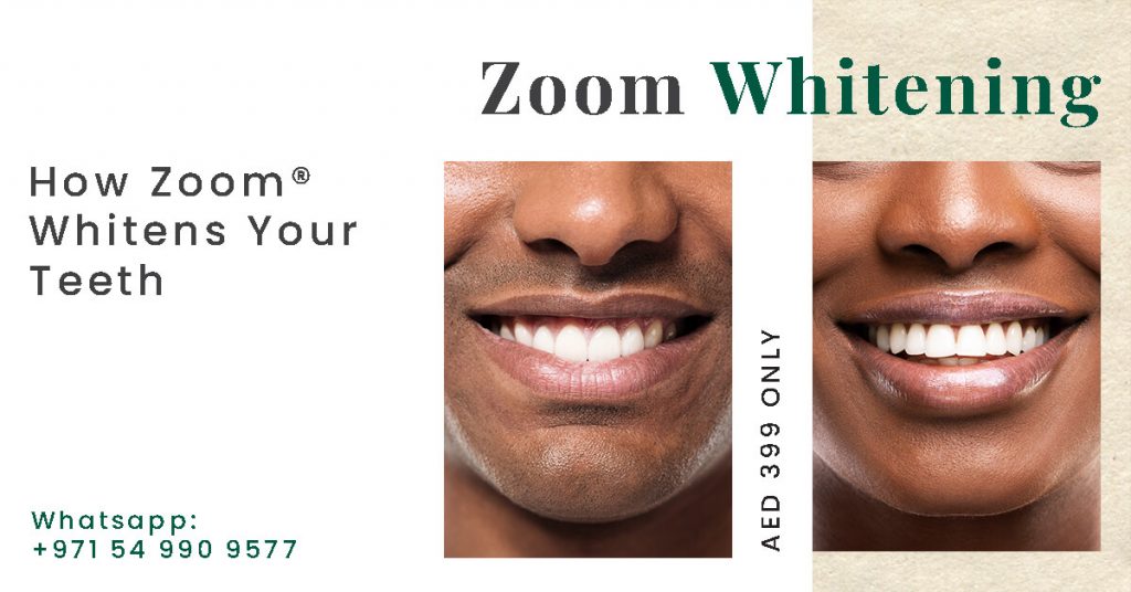 Zoom Teeth Whitening