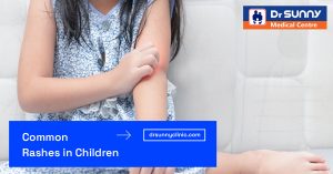 Common Rashes in Children